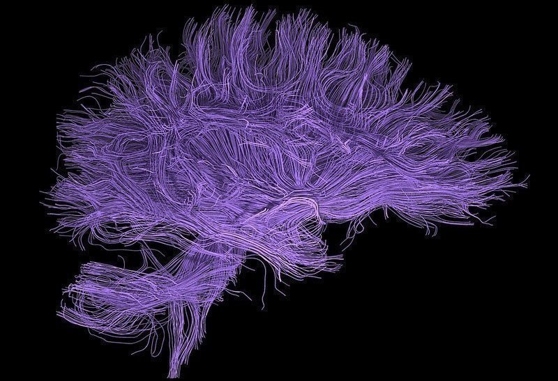 Визуализация нервных волокон мозга