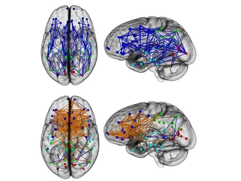 Передача сигналов в мозге мужчин (сверху) и женщин