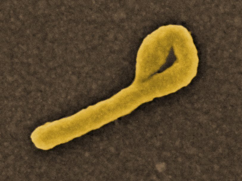Вирус Эбола под электронным микроскопом