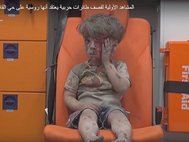 Ребенок, пострадавший при бомбежке в Алеппо