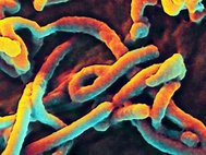 Вирус Эбола под электронным микроскопом