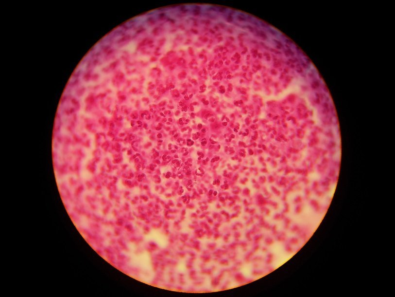 Neisseria gonorrhoeae под микроскопом