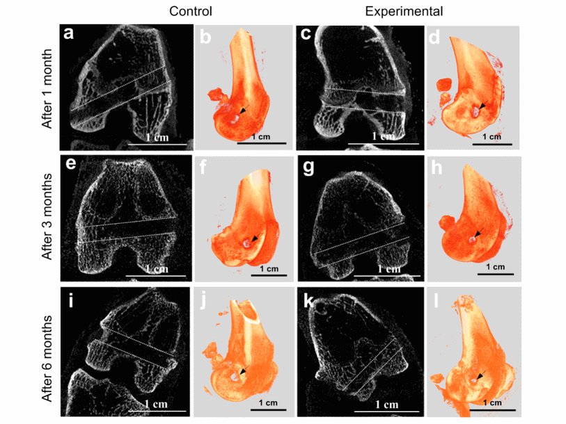 Проекции микротомографии (a, c, e, g, i, k) и трехмерные изображения (b, d, f, h, j, l) поперечного канала бедренной кости для контроля слева и экспериментальные правые коленные суставы через 1, 3 и 6 месяцев после имплантации