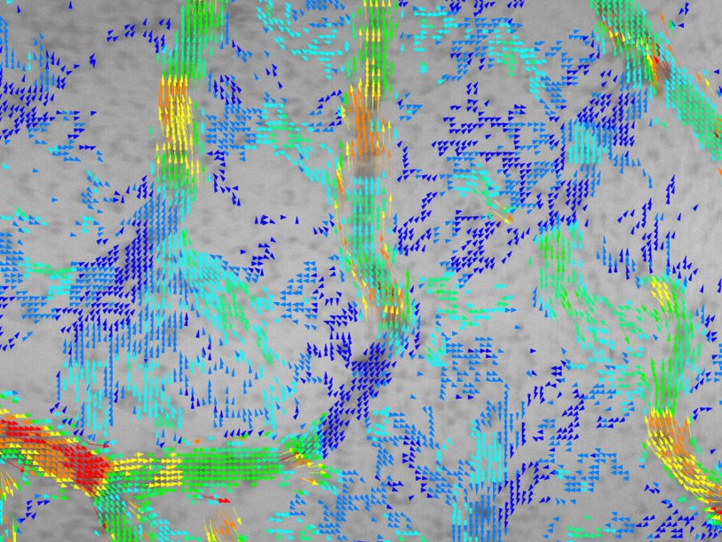 Распределение скорости эритроцитов. Карта построена при помощи разработанного Сколтехом и СГУ метода. Стрелка соответствует одной клетке. Цветом показаны скорости эритроцитов: низкая (синий), средняя (зеленый), высокая (красный)