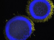 Личинка губки Halisarca dujardinii с флуоресцентной меткой на ДНК (синий), и тубулин — белок жгутиков, находящийся в поверхностных клетках (желтый). Конфокальная лазерная сканирующая микроскопия, 100-кратное увеличение