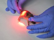 Фотодинамическая терапия основана на активации светом накопившегося в опухолевой ткани фотосенсибилизатора
