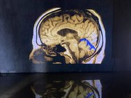 Проекция МРТ мозга